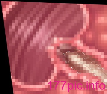 3335